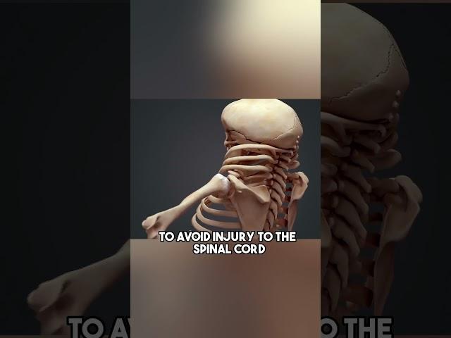 You Can Survive a Car Accident With This Anatomy
