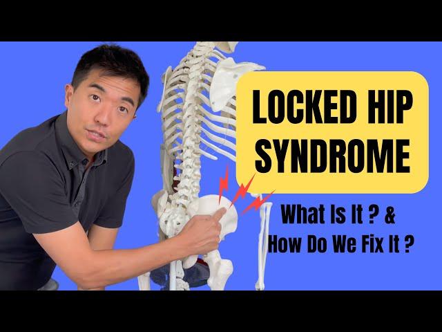 Is It Locked Hip Syndrome? And How Do We Fix It?