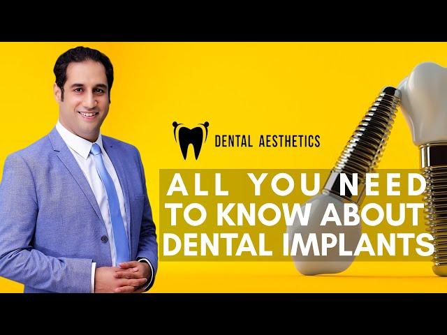 All you need to know about Dental Implants  |  Dr. Shahzad Mirza - Dental Aesthetics