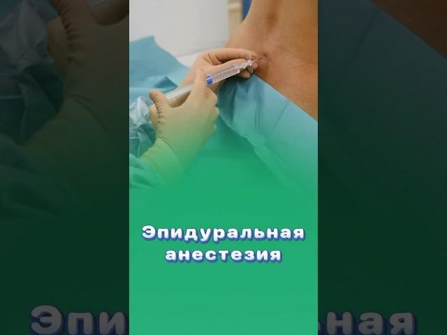 Боли после эпидуральной анестезии! #анестезия #центрздоровья #титовцентр