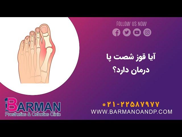 آیا قوز شست پا (هالوکس والگوس) درمان دارد؟ | کلینیک بارمان