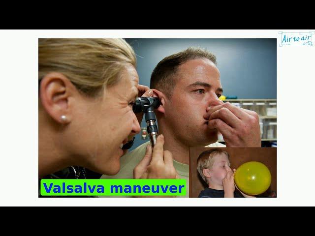 Valsalva maneuver