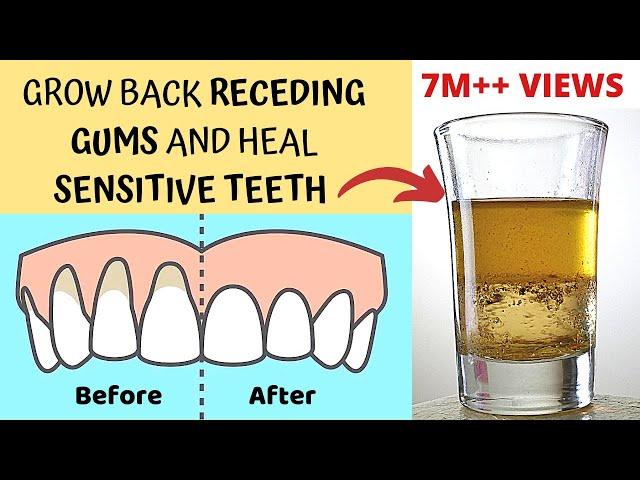 Heal Receding Gums and Grow Back | Treat Sensitive Teeth and Reverse Receding Gums