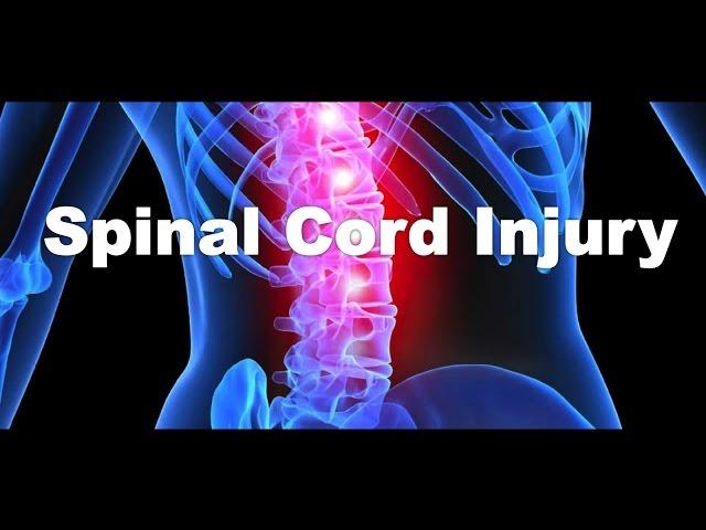 What is a spinal cord injury?