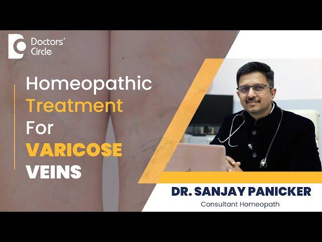 Get Rid of Varicose Veins with Homeopathic Remedies #homeopathy -Dr.Sanjay Panicker| Doctors' Circle