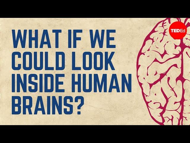 What if we could look inside human brains? - Moran Cerf