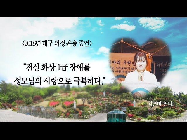 "전신 화상 1급 장애를  성모님의 사랑으로 극복하다." (2018년 대구 피정 증언)