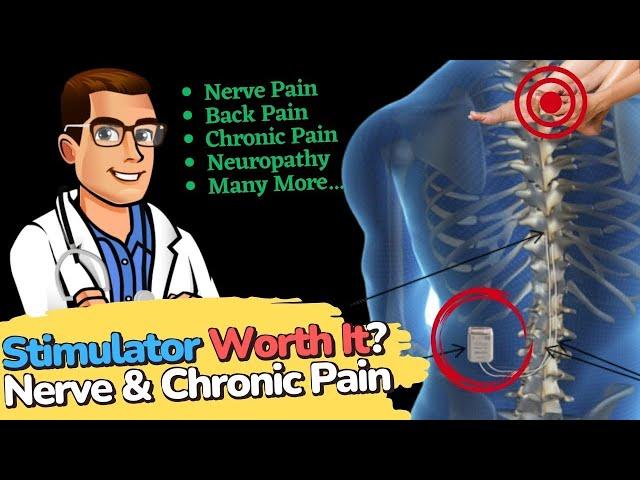 Spinal Cord Stimulator for Chronic Pain? [Neuropathy & Back Pain]