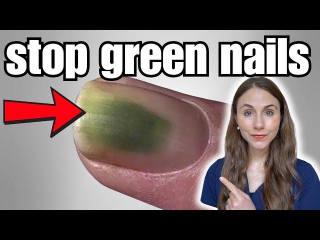 How To Stop Green Nails After Press Ons