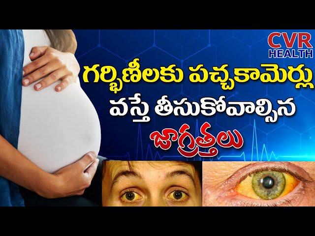 How to Control Jaundice In Pregnancy Period | Pregnancy Tips | Dr. Surya Rao | CVR Health