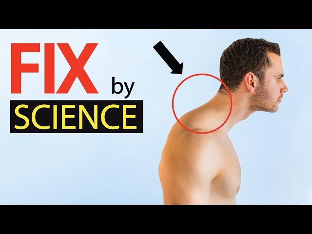 How to FIX Forward Head Posture - Proven by Science (22 studies) + Myth Busting!