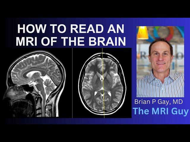 How to read an MRI of the brain | First Look MRI