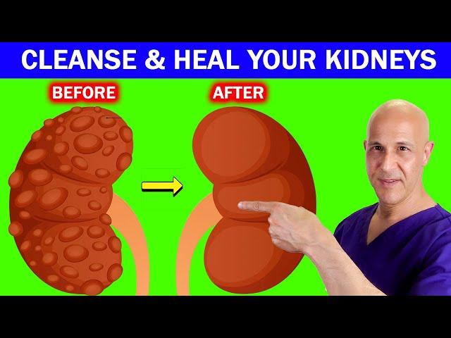 The Best Drinks to Cleanse Out the Toxins, Repair and Heal Your Kidneys!  Dr. Mandell