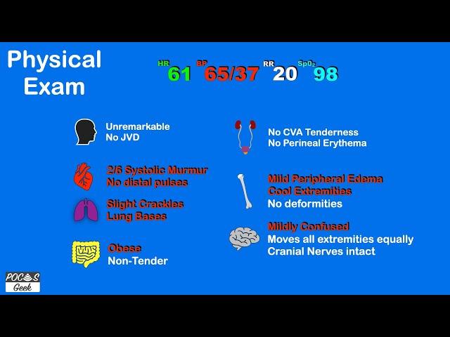 POCUS: Case of Cardiogenic Shock