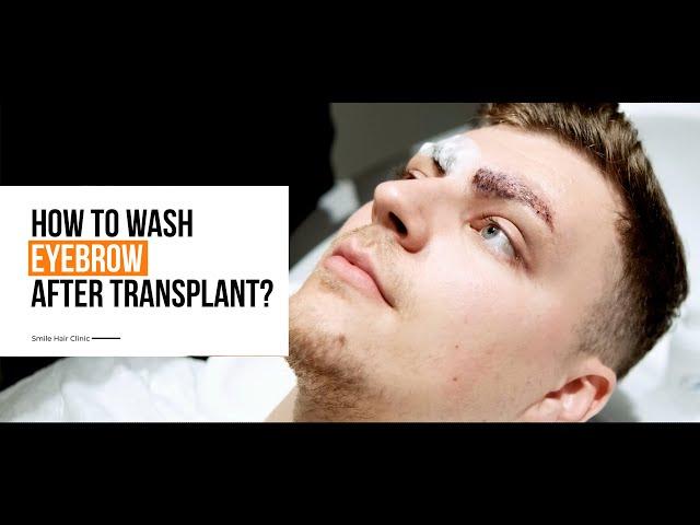 HOW TO WASH YOUR EYEBROW AFTER EYEBROW TRANSPLANT? | DR. FIRDAVS AHMEDOV | SMILE HAIR CLINIC