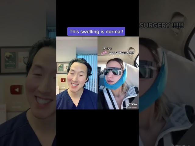 Plastic Surgeon Reacts to Amazing Jaw Surgery REVEAL! #shorts #jawsurgery