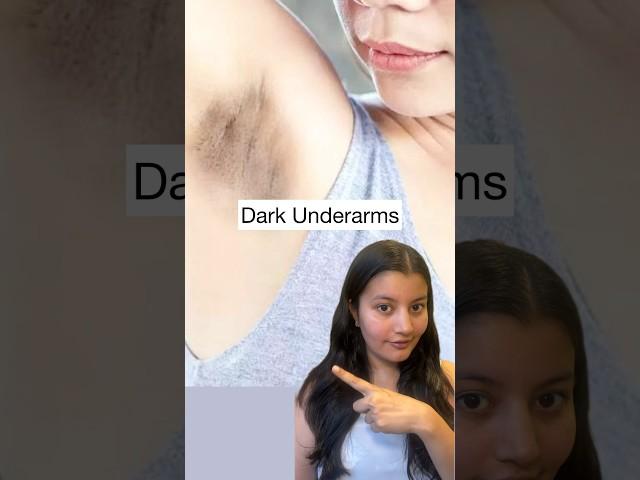 Watch This If You Have DARK Underarms