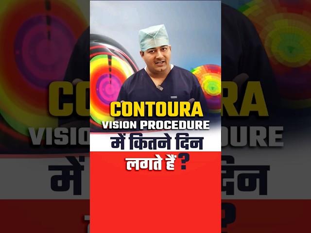 चश्मा हटाने की Contoura लेज़र में कितने दिन लगते हैं?