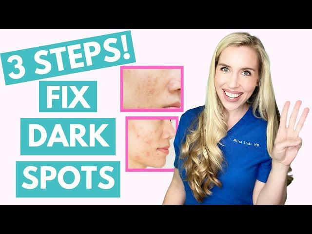 Fix Your Dark Spots in 3 Steps! | Hyperpigmentation | Melasma | Skincare Made Simple