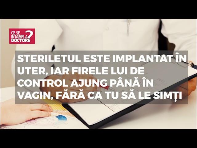 Steriletul: avantaje şi dezavantaje, cu mituri şi laude - VIDEO by CSID