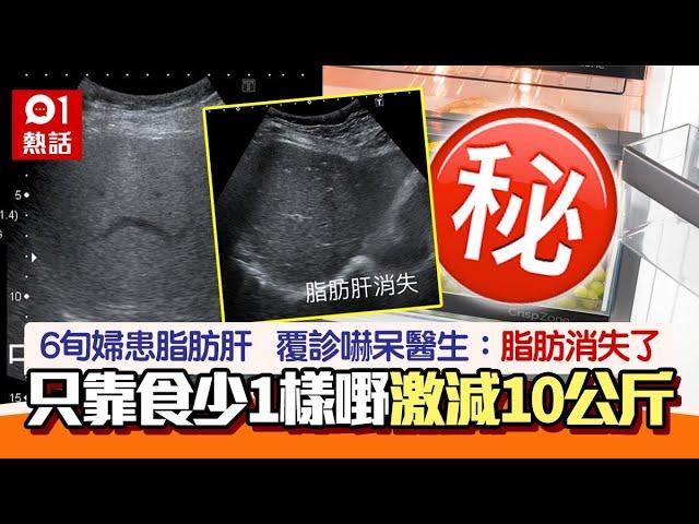 少吃1食物　女子「治好」脂肪肝更勁瘦10公斤　醫生一看超驚訝｜01熱話｜脂肪肝｜高血壓｜健康