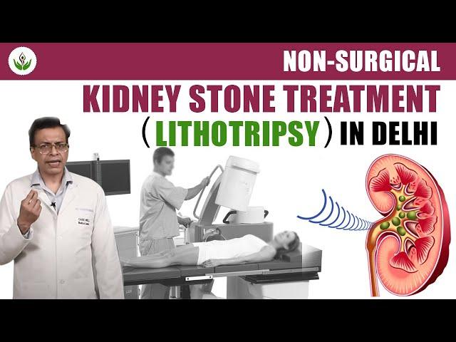 Non Surgical Kidney Stone Treatment (Lithotripsy) in Delhi | Care Well Medical Centre