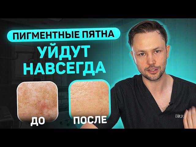 Пигментные пятна на лице. Как я лечу мезму у своих пациентов