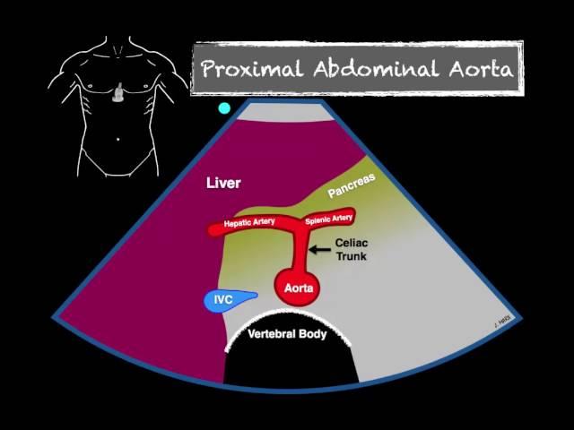 Bedside Ultrasound Abdominal Aorta