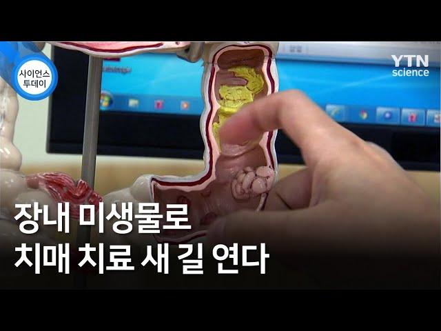 장내 미생물로 치매 치료 새 길 연다 / YTN 사이언스