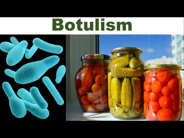 Canned Foods and Botulism: What Every Consumer Should Know | Clostridium botulinum | Botulinum Toxin