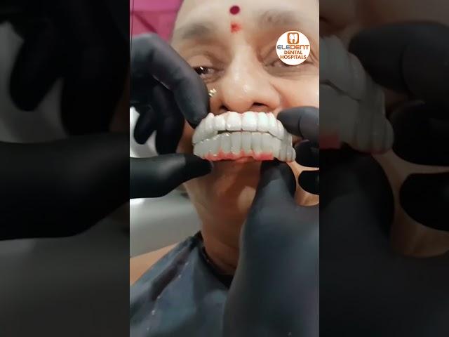 Full Mouth Dental Implants | Smile Transformation | Best Dental Hospital In INDIA | Eledent Hospital