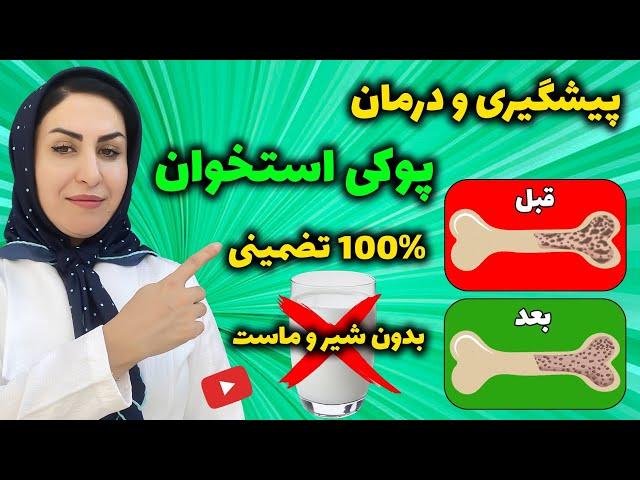 با این 10 خوراکی روند پوکی استخوان را در 60 سالگی معکوس کنید!  | درمان پوکی استخوان 100% تضمینی