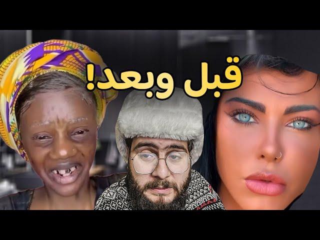 يا رب ما يطلع شب ! ️ | عاهات تيك توك