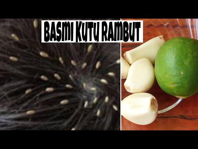 CARA MENGHILANGKAN KUTU RAMBUT DAN TELUR NYA DENGAN CEPAT!