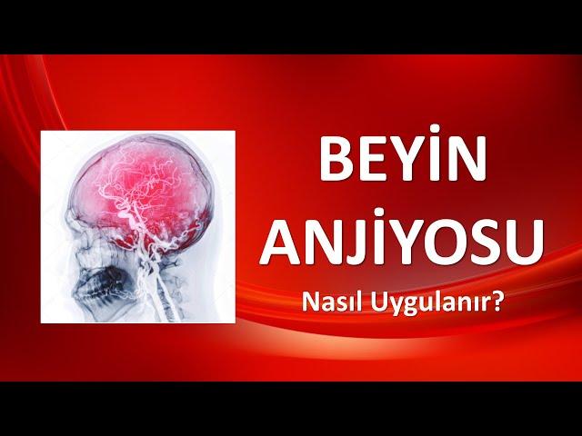 BEYİN ANJİYOSU Nasıl Uygulanır?