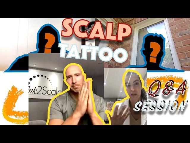 Scalp Micropigmentation: Real Talk with Dan and Will | Ink 2 Scalp Hair Studios | Ontario