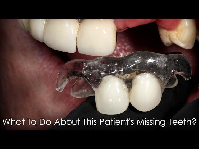 What to do About This Patient's Missing Teeth