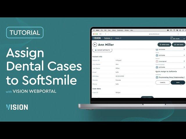 Tutorial: Assign Dental Cases to SoftSmile | Dental Treatment Planning Software