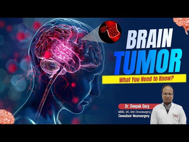 Brain Tumor: What You Need to Know? | Jeevan Rekha Superspeciality Hospital, Jaipur