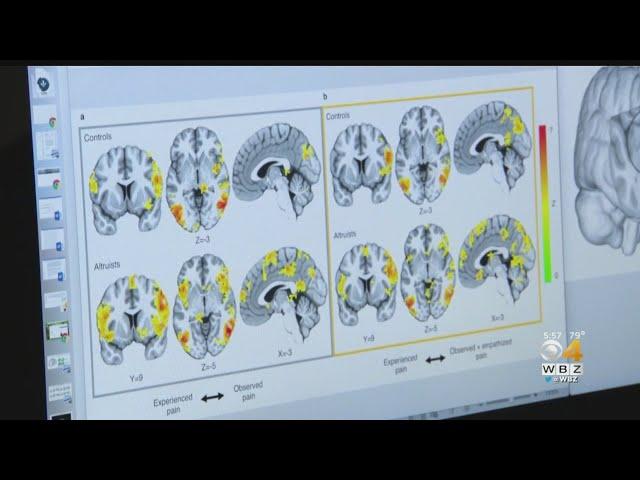 A Closer Look At The Mind Of An Altruistic Kidney Donor