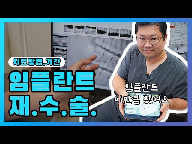 (EP.8) 임플란트 재수술, 치료 방법과 기간 그리고 통증