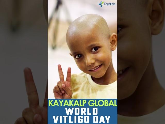 Celebrating Vitiligo Day 2024 | Kayakalp Global #shorts #shortsfeed