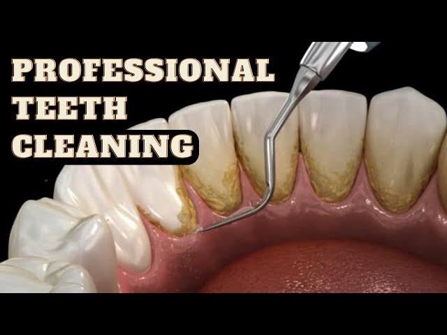 professional tooth or teeth cleaning or scaling | Facets dental clinic.