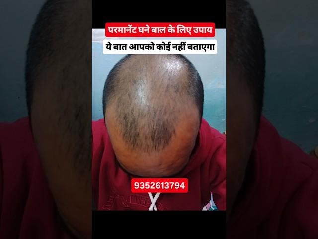 jamalgota se baal ugane ka tarika #jamalgota #jamalgotaseedforhair #jamalgotaoil #jamalgotapowder #