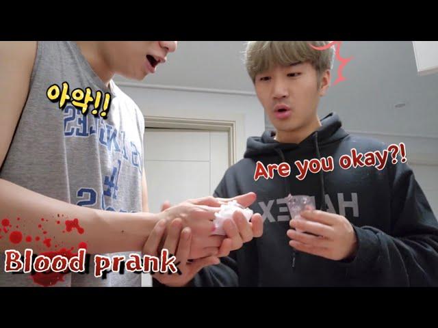 Gay couple prank! If I hurt my hand and I'm bleeding... What's my boyfriend's reaction?