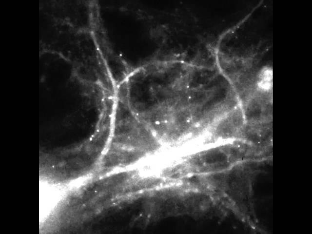 The Molecular Basis of Memory: Tracking mRNA in Brain Cells in Real Time