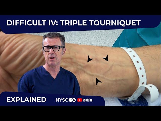 Difficult Intravenous (IV) cannulation #2: Triple Tourniquet Technique