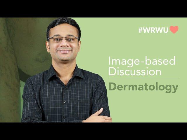 #WRWU Image Based Discussion - Dermatology