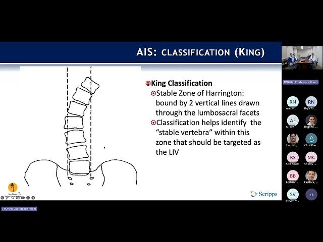 Adolescent Idiopathic Scoliosis : Nikita Lakomkin, MD