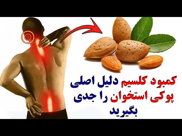 جلوی پوکی استخوان را هر چه زودتر با مصرف بهترین منابع گیاهی بگیریم